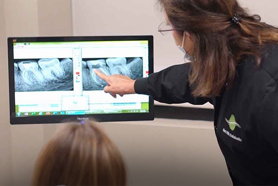 Endodontic Procedures Image